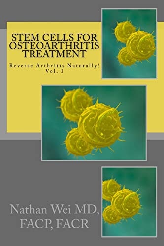 Stem Cells for Osteoarthritis Treatment An Easy to Understand Consumer's Guide to Understanding How Stem Cells Are Used to Treat Osteoarthritis