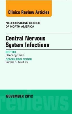 Central Nervous System Infections, an Issue of Neuroimaging Clinics: Volume 22-4