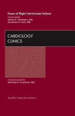 Faces of Right Ventricular Failure, an Issue of Cardiology Clinics: Volume 30-2
