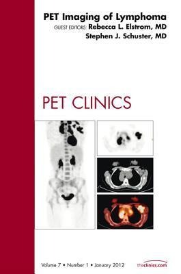 Pet Imaging of Lymphoma, an Issue of Pet Clinics: Volume 7-1