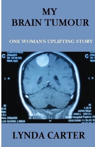 My Brain Tumour One Woman's Uplifting Story
