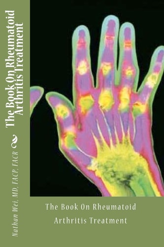 The Book on Rheumatoid Arthritis Treatment
