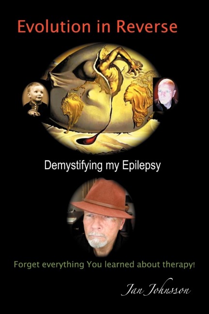 Evolution in Reverse: Demystifying My Epilepsy