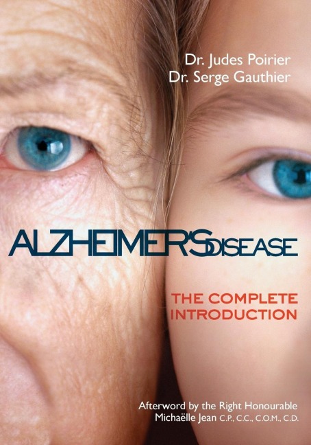Alzheimers Disease: The Complete Introduction