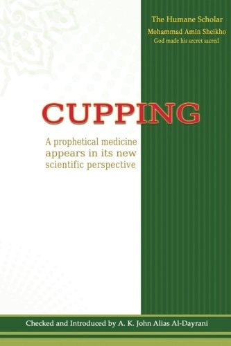 Cupping A Prophetical Medicine Appears in Its New Scientific Perspective