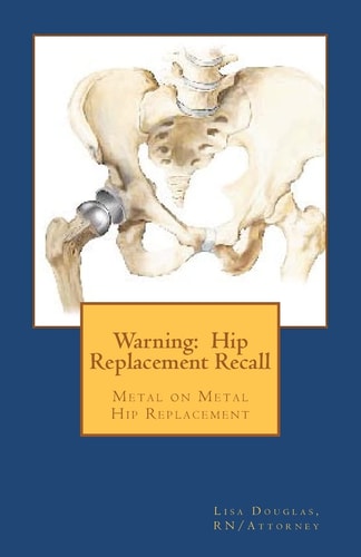 Warning: Hip Replacement Recall Warning: Hip Replacement Recall Metal on Metal Devices