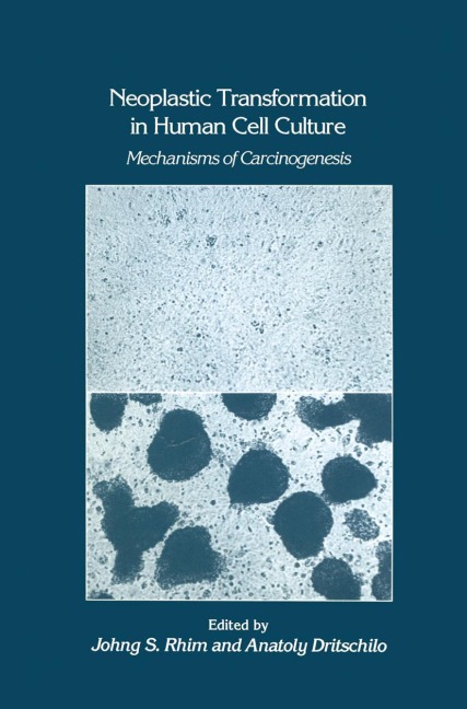 Neoplastic Transformation in Human Cell Culture: Mechanisms of Carcinogenesis