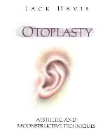 Otoplasty: Aesthetic and Reconstructive Techniques
