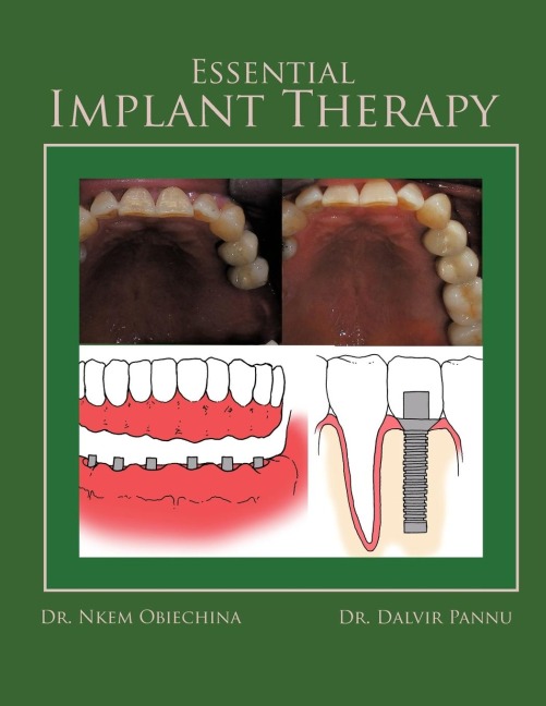 Essential Implant Therapy: A Patients Guide to Understanding Implant Dentistry