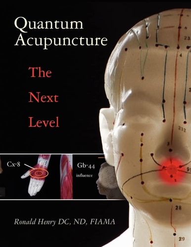 Quantum Acupuncture - The Next Level
