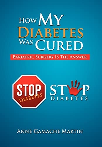 How My Diabetes Was Cured Bariatric Surgery Is The Answer