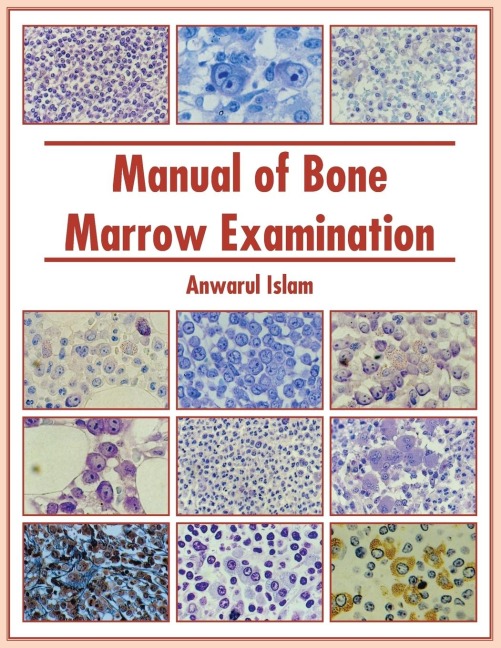 Manual of Bone Marrow Examination