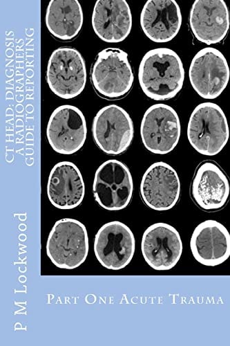 CT Head DIAGNOSIS A Radiographers Guide To Reporting Part 1 Acute Trauma: Part One Acute Trauma