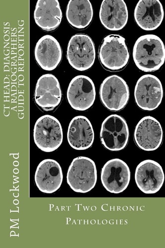CT Head DIAGNOSIS A Radiographers Guide To Reporting Part 2 Chronic Pathologies: Part 2 Chronic Pathologies