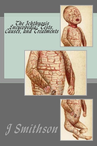 The Ichthyosis Encycopedia Tests, Causes, and Treatments