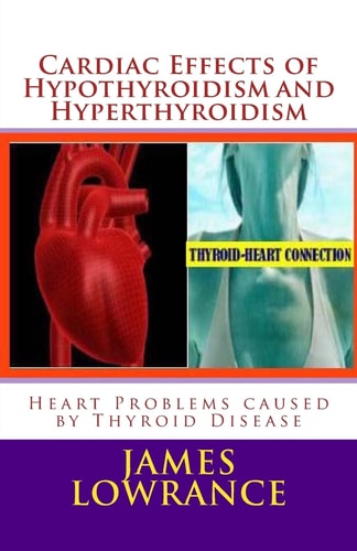 Cardiac Effects of Hypothyroidism and Hyperthyroidism Heart Problems Caused by Thyroid Disease