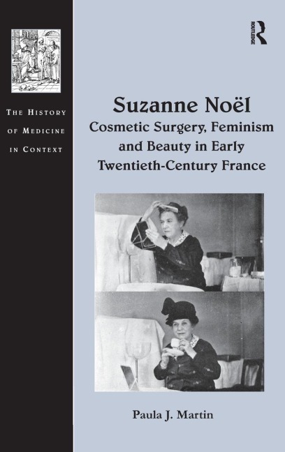Suzanne Noël: Cosmetic Surgery, Feminism and Beauty in Early Twentieth-Century France