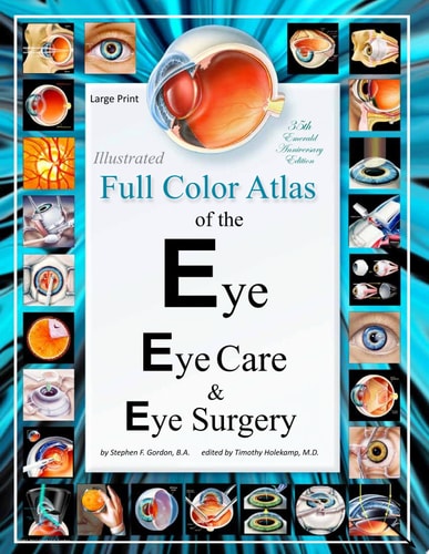 Illustrated Full Color Atlas of the Eye, Eye Care, and Eye Surgery - LARGE PRINT Edition