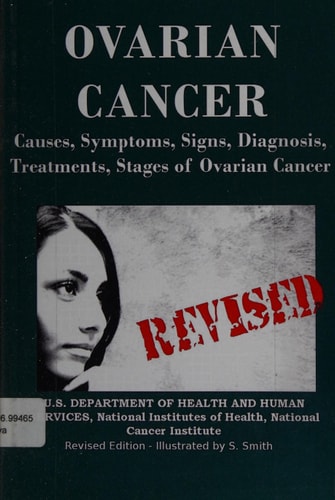 Ovarian Cancer Causes, Symptoms, Signs, Diagnosis, Treatments, Stages of Ovarian Cancer