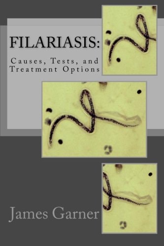 Filariasis Causes, Tests, and Treatment Options