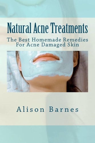 Natural Acne Treatments The Best Homemade Remedies for Acne Damaged Skin