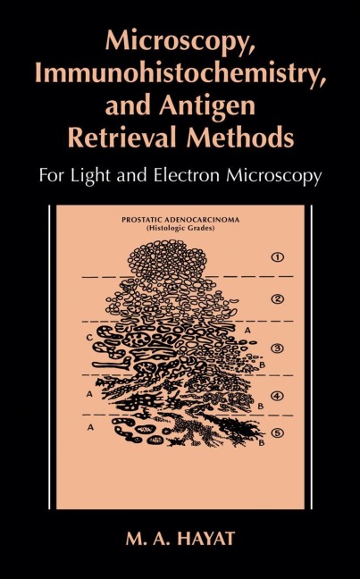 Microscopy, Immunohistochemistry, and Antigen Retrieval Methods: For Light and Electron Microscopy