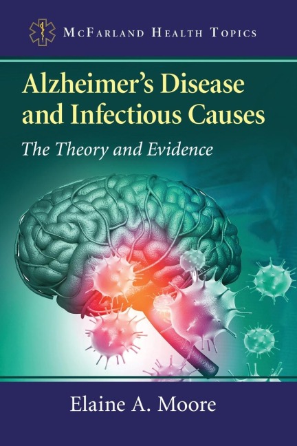 Alzheimers Disease and Infectious Causes: The Theory and Evidence