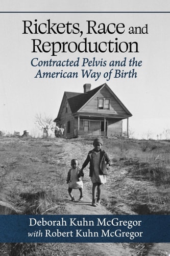 Rickets, Race and Reproduction Contracted Pelvis and the American Way of Birth