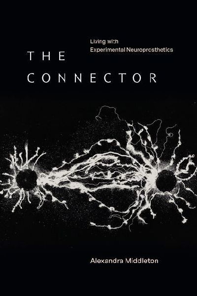 The Connector: Living with Experimental Neuroprosthetics