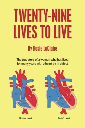 Twenty-Nine Lives to Live