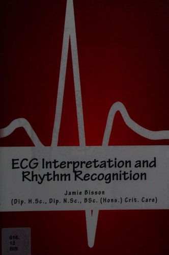 ECG Interpretation and Rhythm Recognition