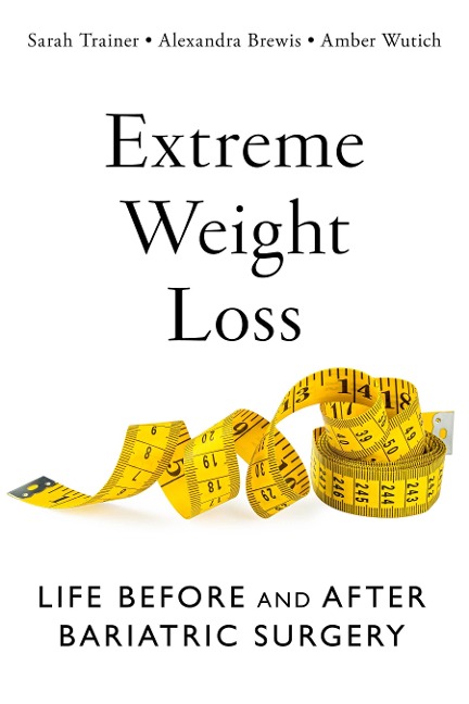 Extreme Weight Loss: Life Before and After Bariatric Surgery