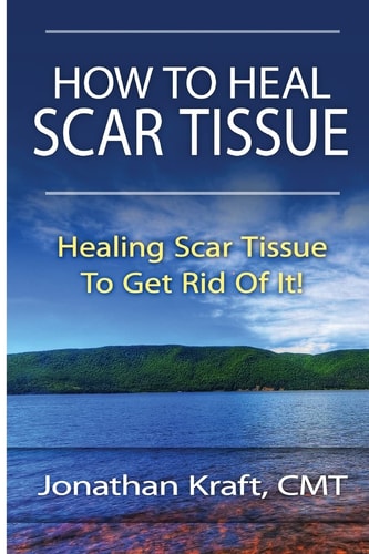 How to Heal Scar Tissue How to Heal Your Own Scar Tissue And Get Rid Of It!