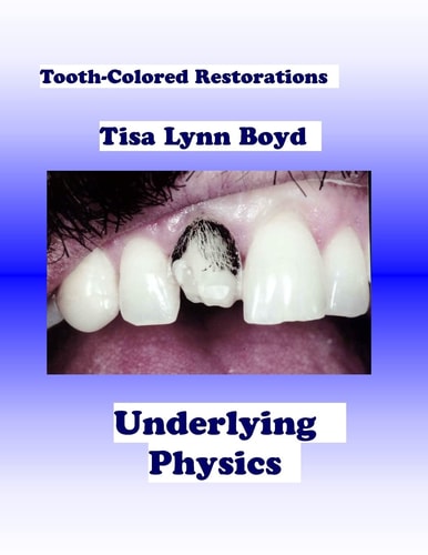 Tooth-Colored Restorations Underlying Physics