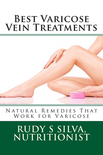 Best Varicose Vein Treatments Natural Remedies That Work For Varicose