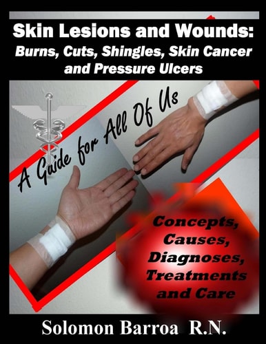 Skin Lesions and Wounds Burns, Cuts, Shingles, Skin Cancer and Pressure Ulcer: ( Concepts, Causes, Diagnoses, Treatment and Care )