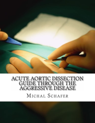 Acute Aortic Dissection Guide Through the Aggressive Disease