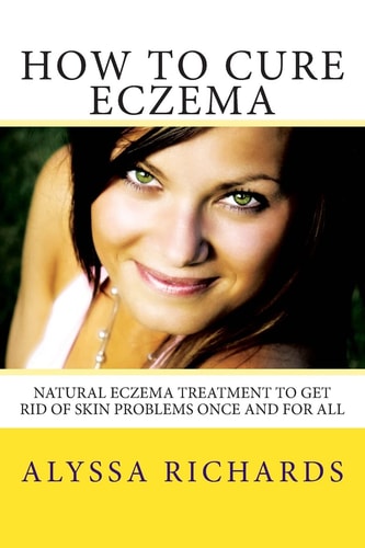 How to Cure Eczema Natural Eczema Treatment to Get Rid of Skin Problems Once and for All
