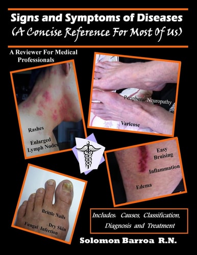 Signs and Symptoms of Diseases A Concise Reference for Most of Us and a Reviewer for Medical Professionals