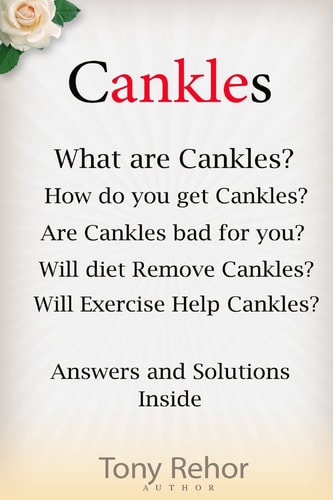 Cankles This Guide Will Answer All of Your Cankles Questions