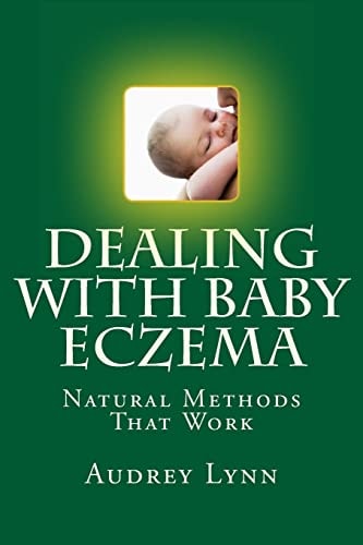 Dealing With Baby Eczema Natural Methods That Work