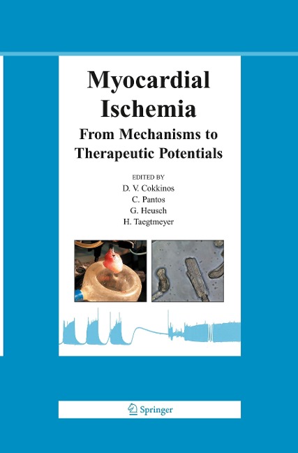 Myocardial Ischemia: From Mechanisms to Therapeutic Potentials