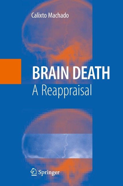 Brain Death: A Reappraisal