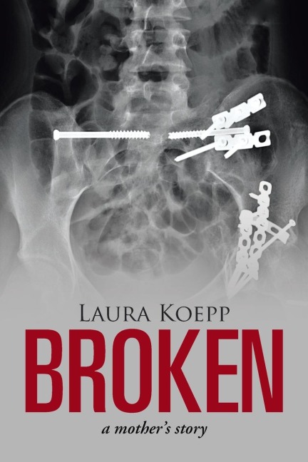 Broken: a mothers story