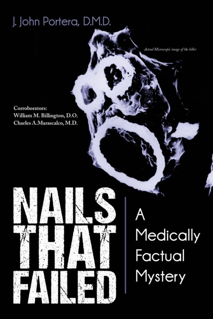 Nails That Failed: A Medically Factual Mystery