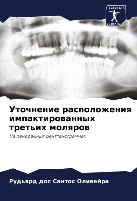 Tetelestai