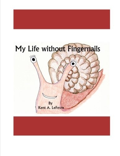 My Life Without Fingernails