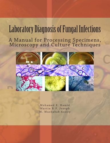 Laboratory Diagnosis of Fungal Infections A Manual for Processing Specimens, Microscopy and Culture Techniques