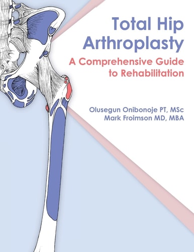 Total Hip Arthroplasty A Comprehensive Guide to Rehabilitation