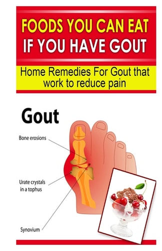Foods You Can Eat If You Have Gout Home Remedies for Gout That Work to Reduce Pain